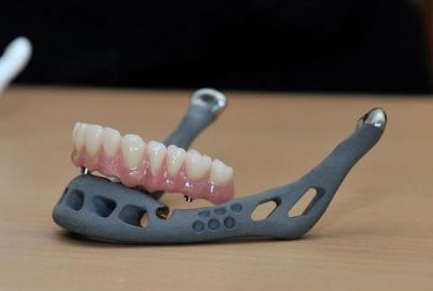 Carnegie Mellon University Research May Lead to Enhanced Design to Reduce Porosity in 3D Printed Titanium, Leading to Stronger Parts - 3DPrint.com | Additive Manufacturing Business