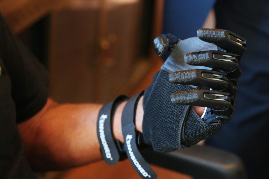 Florida Man Receives New 3D Printed Hands From e-NABLE - 3DPrint.com | Additive Manufacturing Business