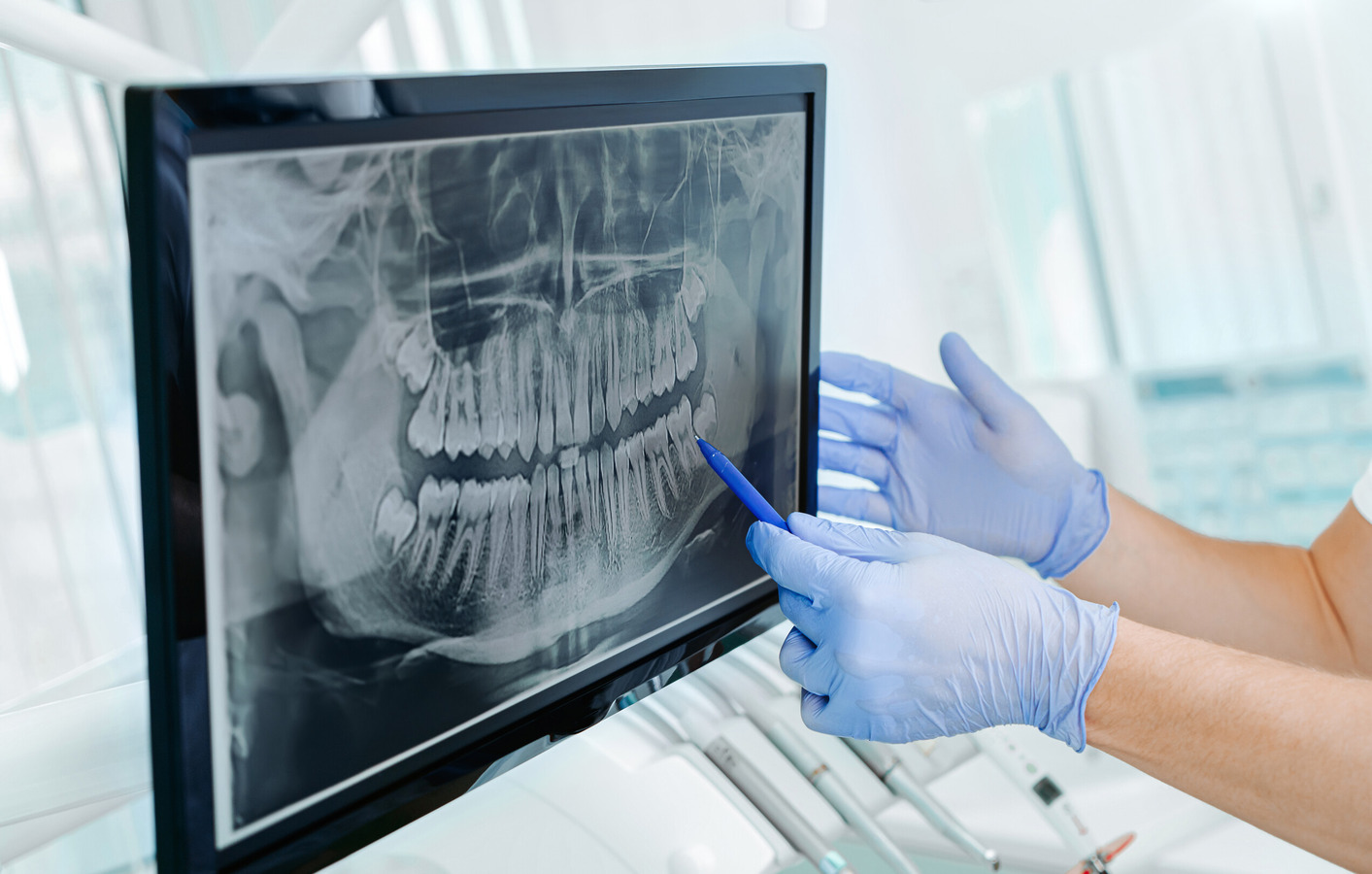 Are Dental X-Rays safe? | American Association of Orthodontists