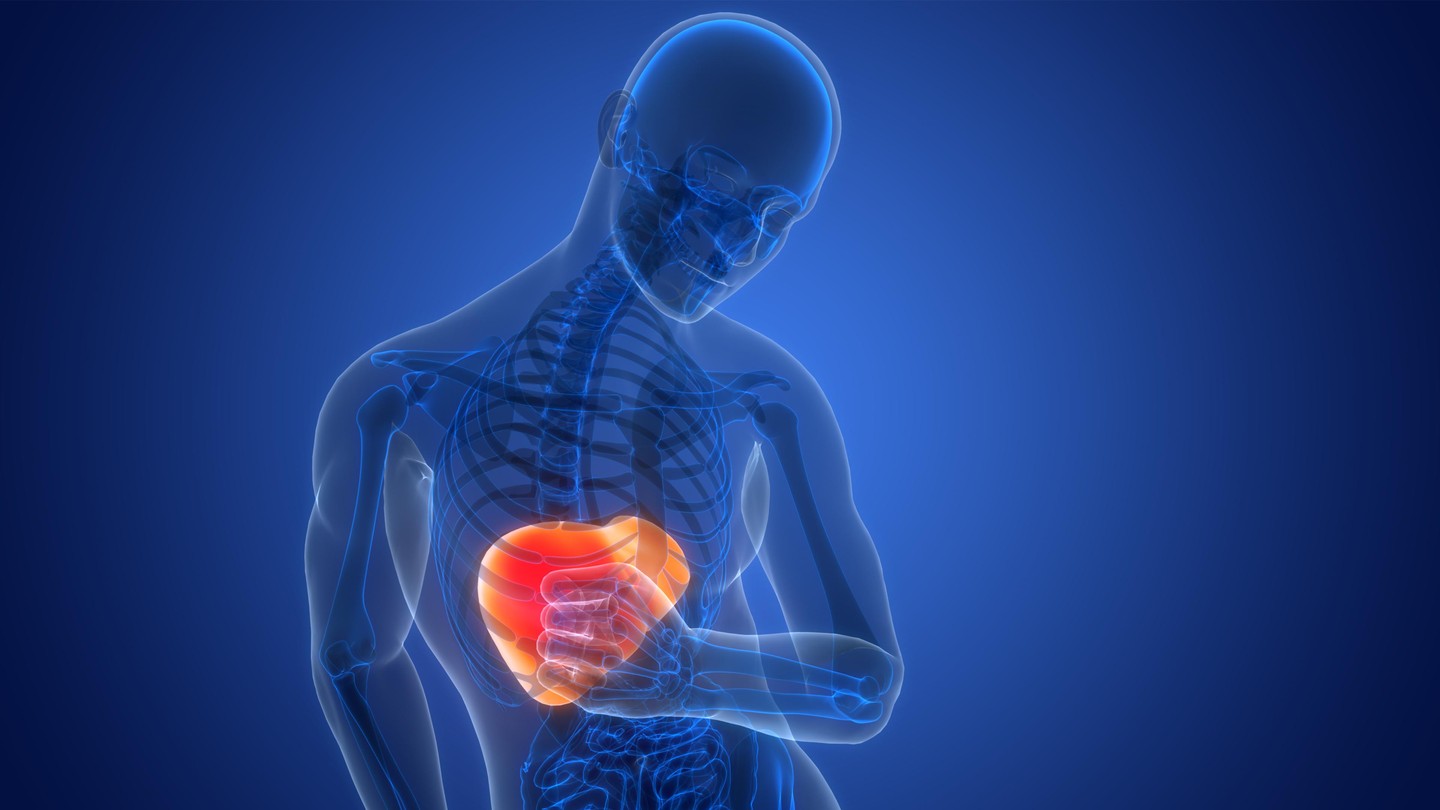 A novel approach to combat fatty liver disease - EPFL