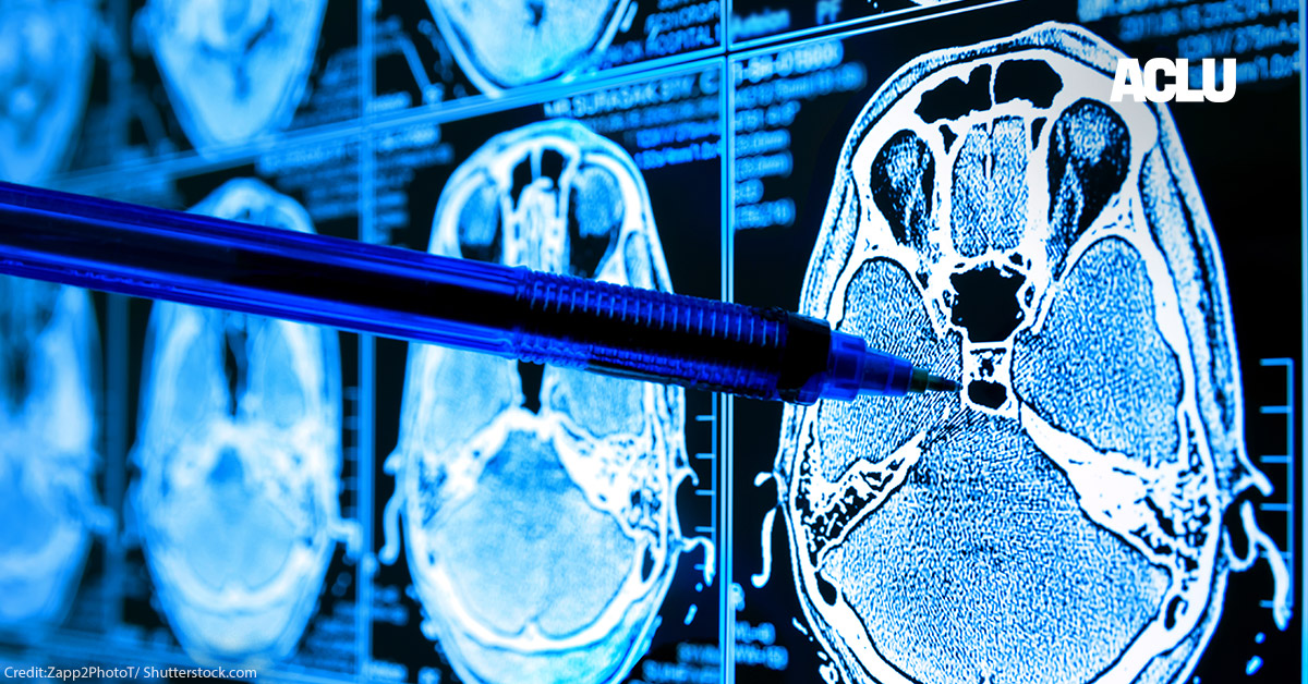 Algorithms Are Making Decisions About Health Care, Which May Only Worsen Medical Racism | American Civil Liberties Union