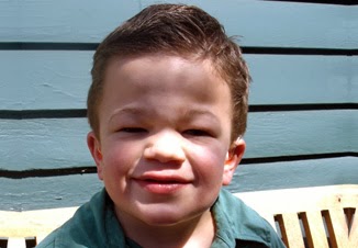Stem cell gene therapy combination could help children battling a rare genetic disorder | The Stem Cellar
