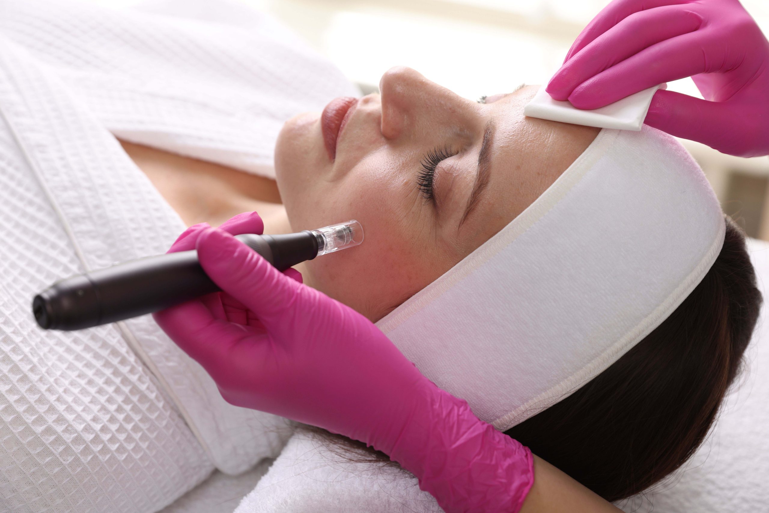 Want to stimulate collagen in your face? Try microneedling! - Baylor College of Medicine Blog Network