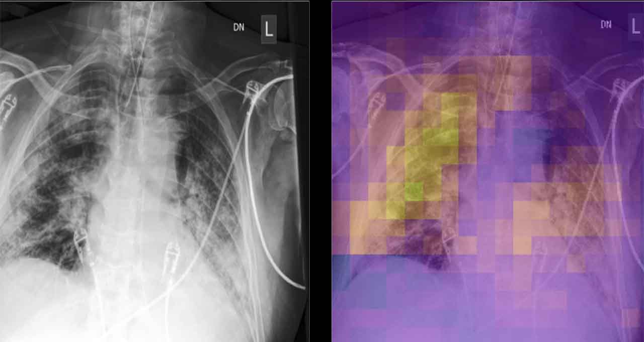 Martinos Center Adopts AI for COVID Research | NVIDIA Blog
