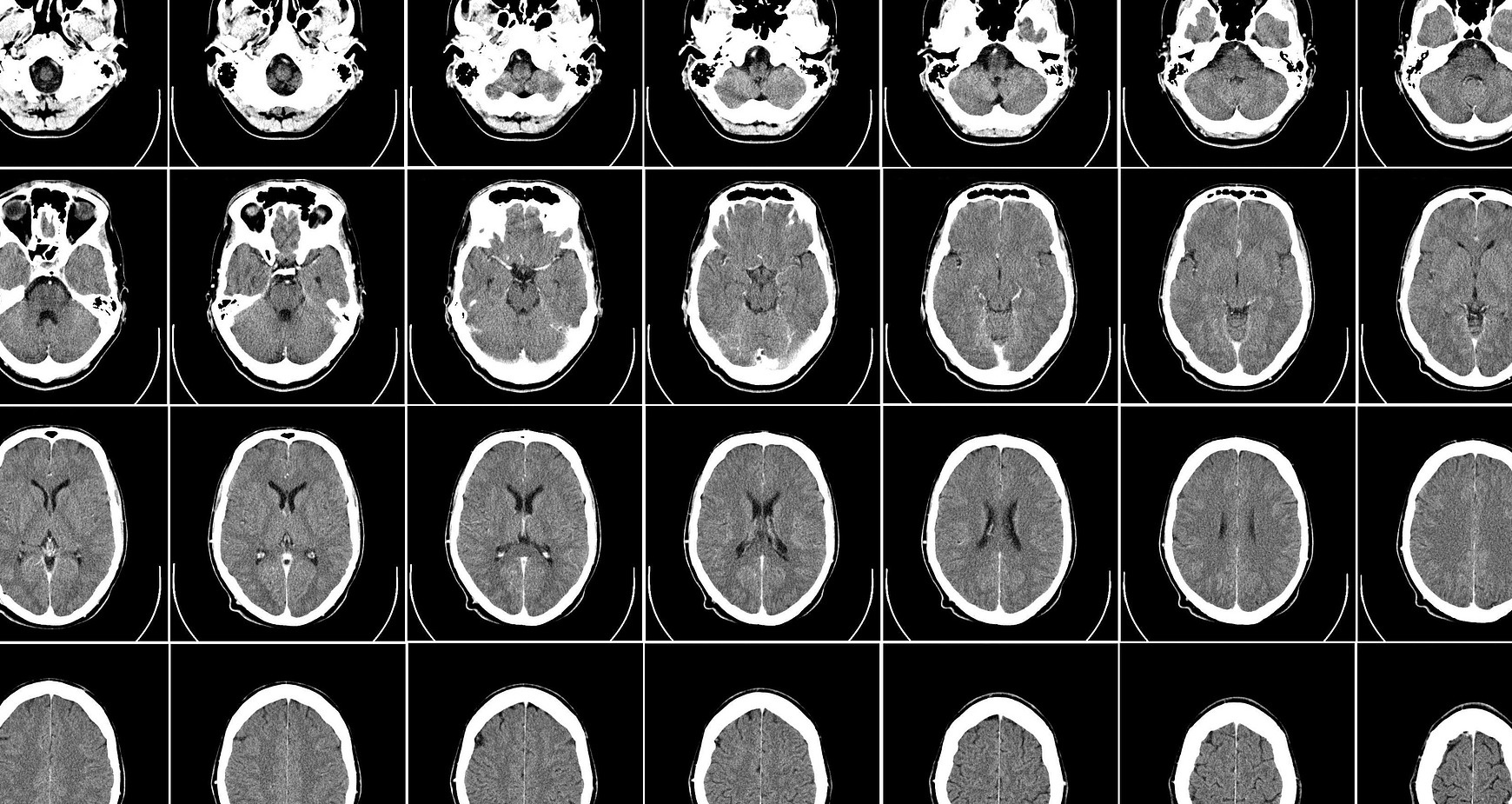 KCL Uses AI to Generate 100,000 Brain Images | NVIDIA Blogs