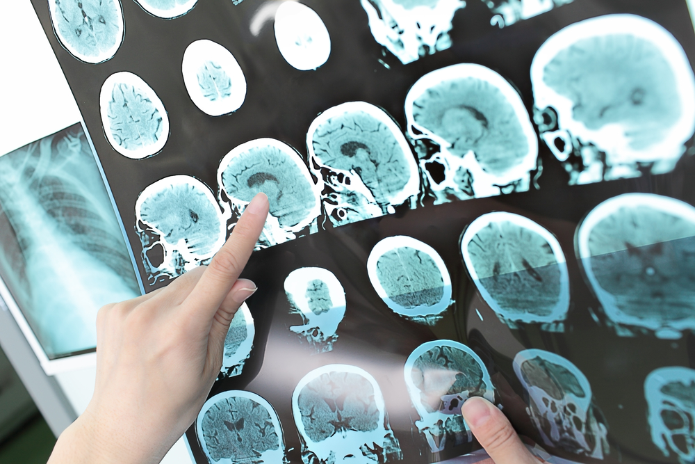 Best and Worst of Health and Healthcare – March 2015 | Brain Blogger