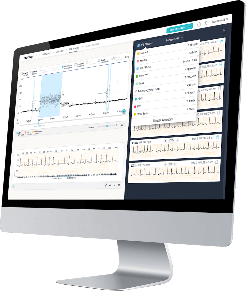 AI study launched to monitor cardiac safety of COVID-19 patients receiving hydroxychloroquine