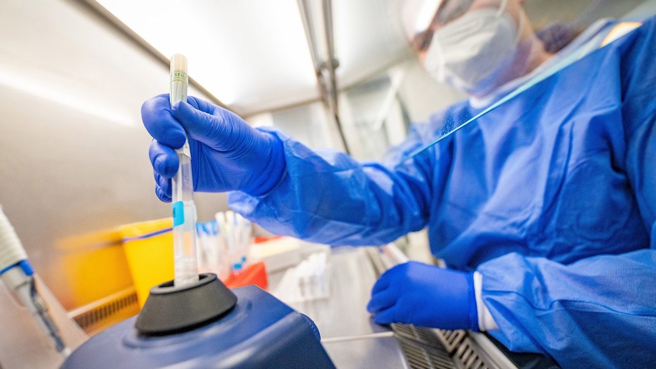 Científicos explican los mecanismos de defensa del cuerpo contra el contagio de algunos virus
