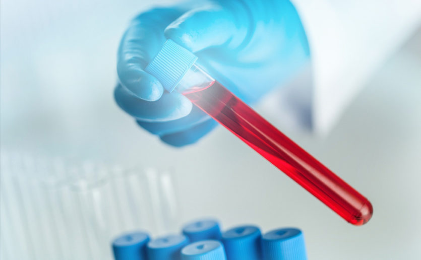 Global Cancer Liquid Biopsy Products Market $33.5 Billion by 2033