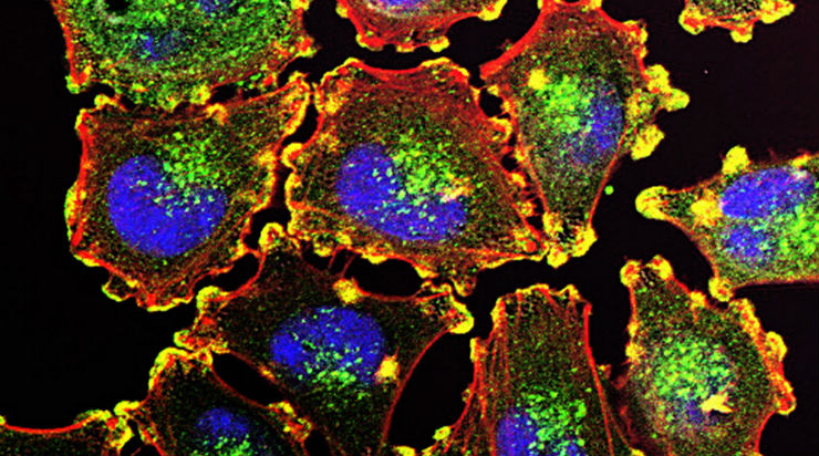 IMA Gold Medal Lecture 2023 - Modelling collective cell movement in biology and medicine - IMA