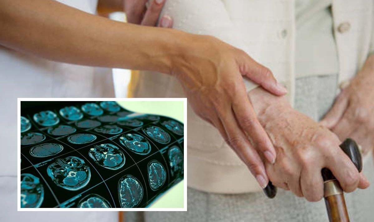 Vascular dementia signs: The 'movement problems' that can 'get worse over time' | Express.co.uk