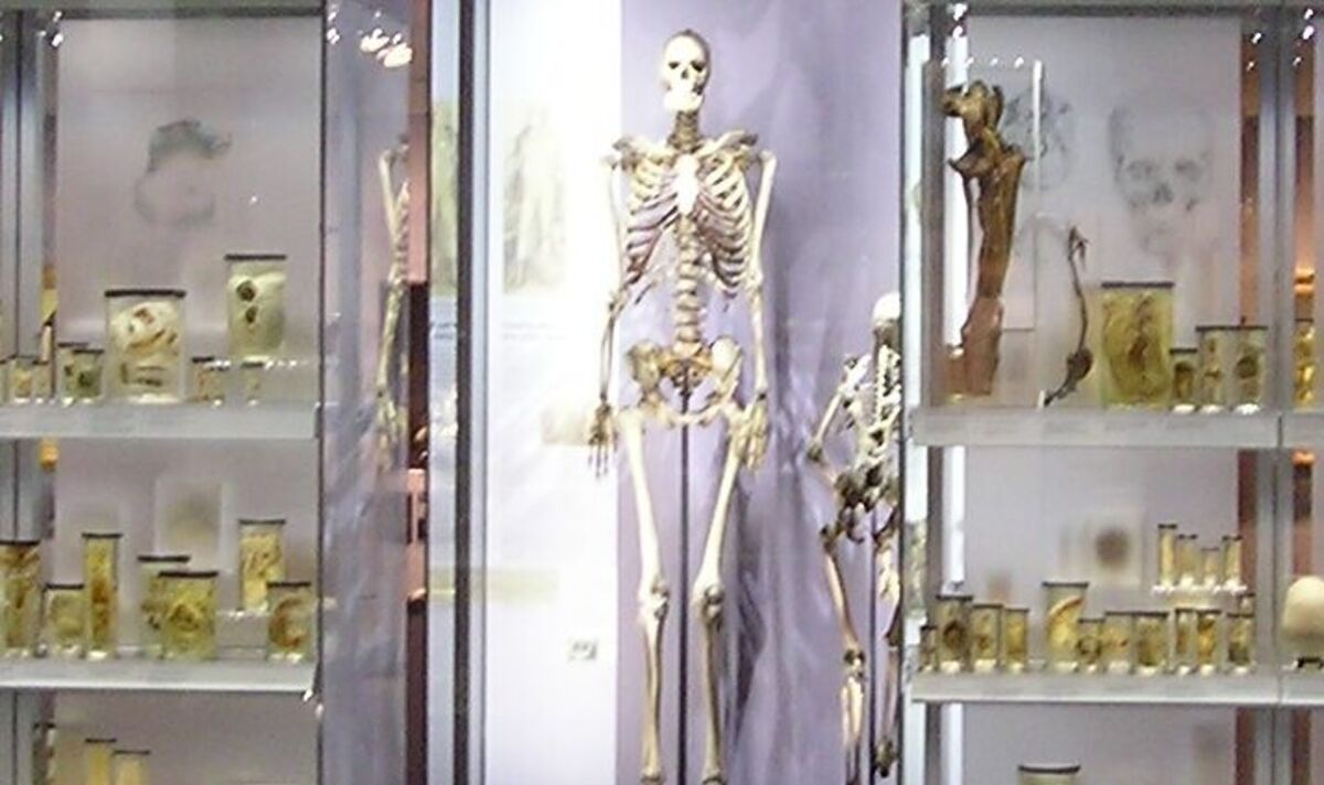 Skeleton of 18th century giant removed from display after surgeon snatched his body | Science | News | Express.co.uk