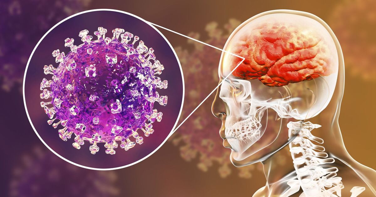 UK monitoring brain-swelling virus that could cause pandemic | World | News | Express.co.uk