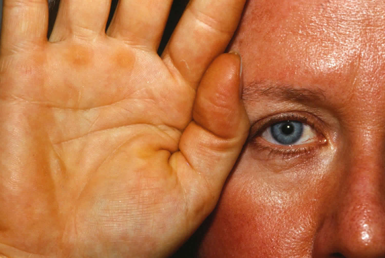 What Happens To Your Body If You Take Too Many Supplements