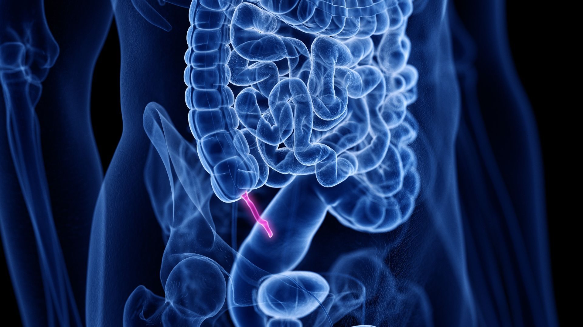 The appendix evolved at least 32 times across 361 species, so it's 'unlikely to be a useless evolutionary accident,' research finds | Live Science