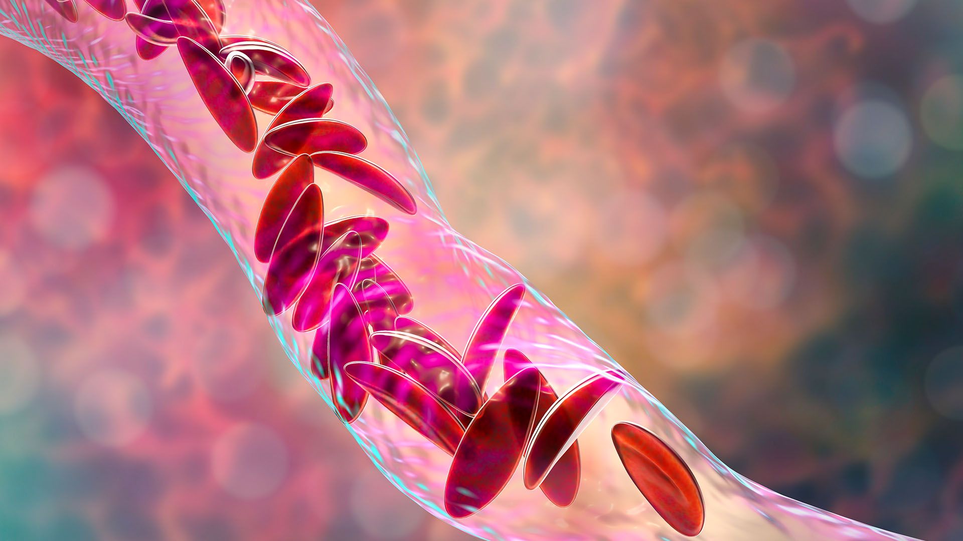 The world's 1st CRISPR therapy has been approved. Here's everything you need to know | Live Science