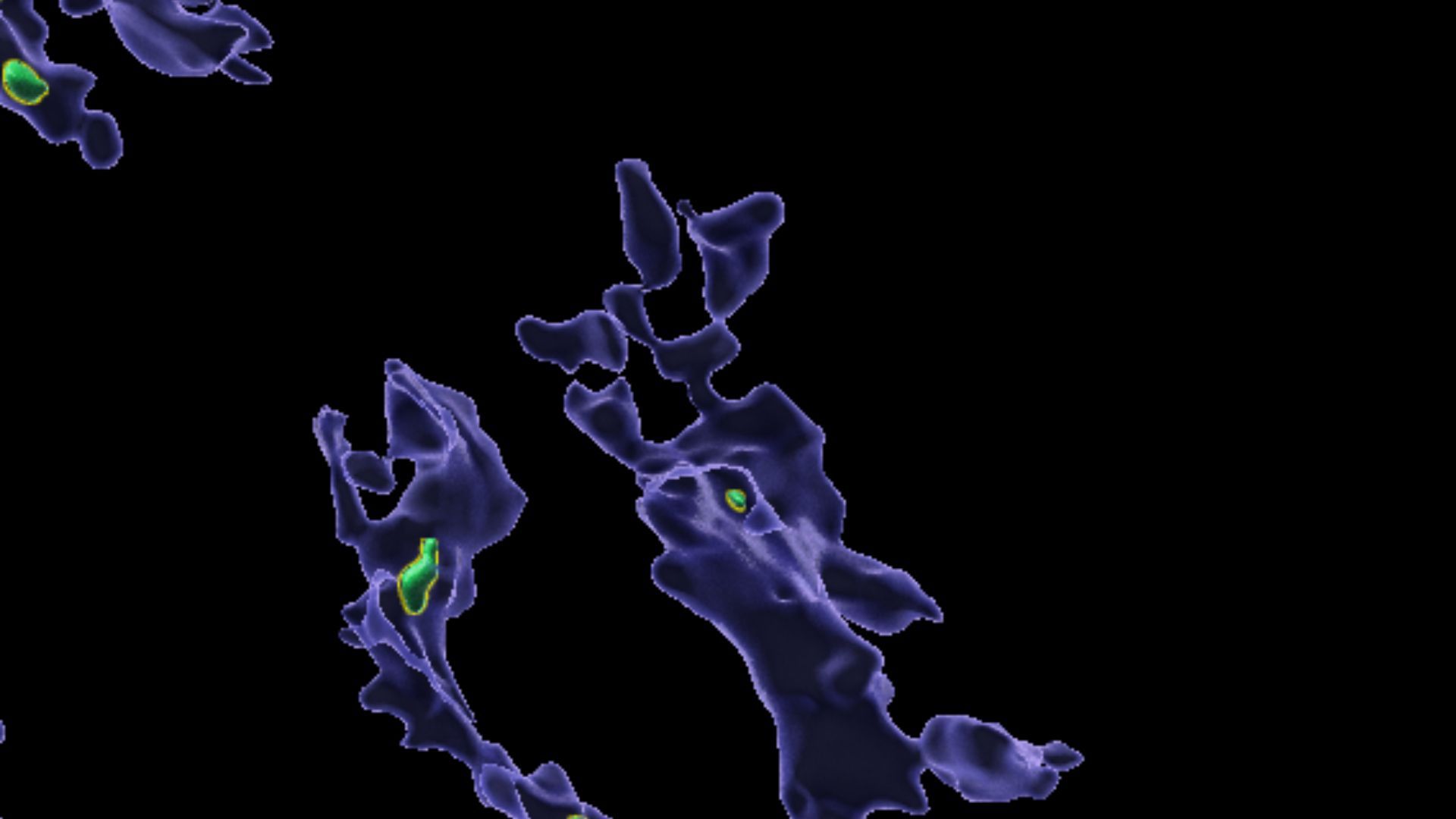 Microplastics that accumulate in the body may 'clog up' immune cells | Live Science