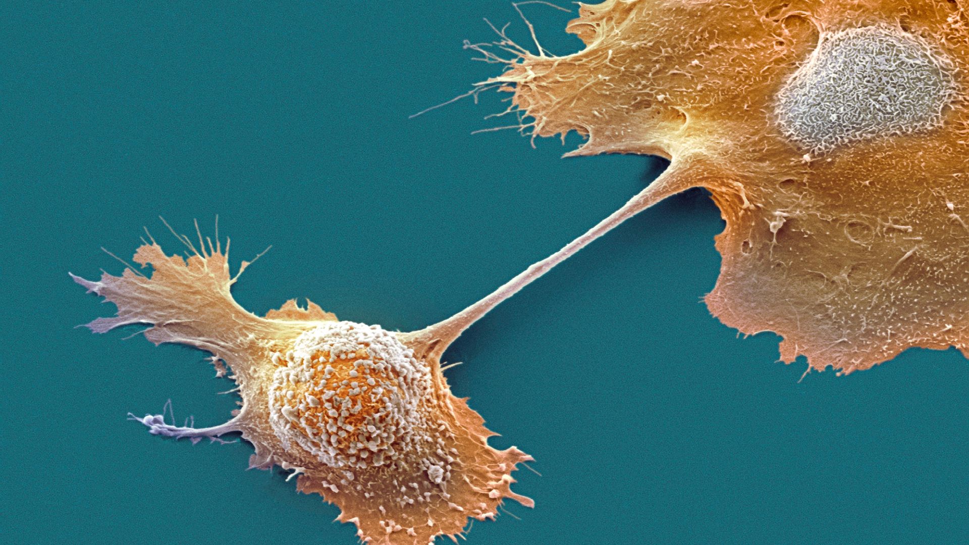 Experimental drug doubles one-year survival in pancreatic cancer | Live Science