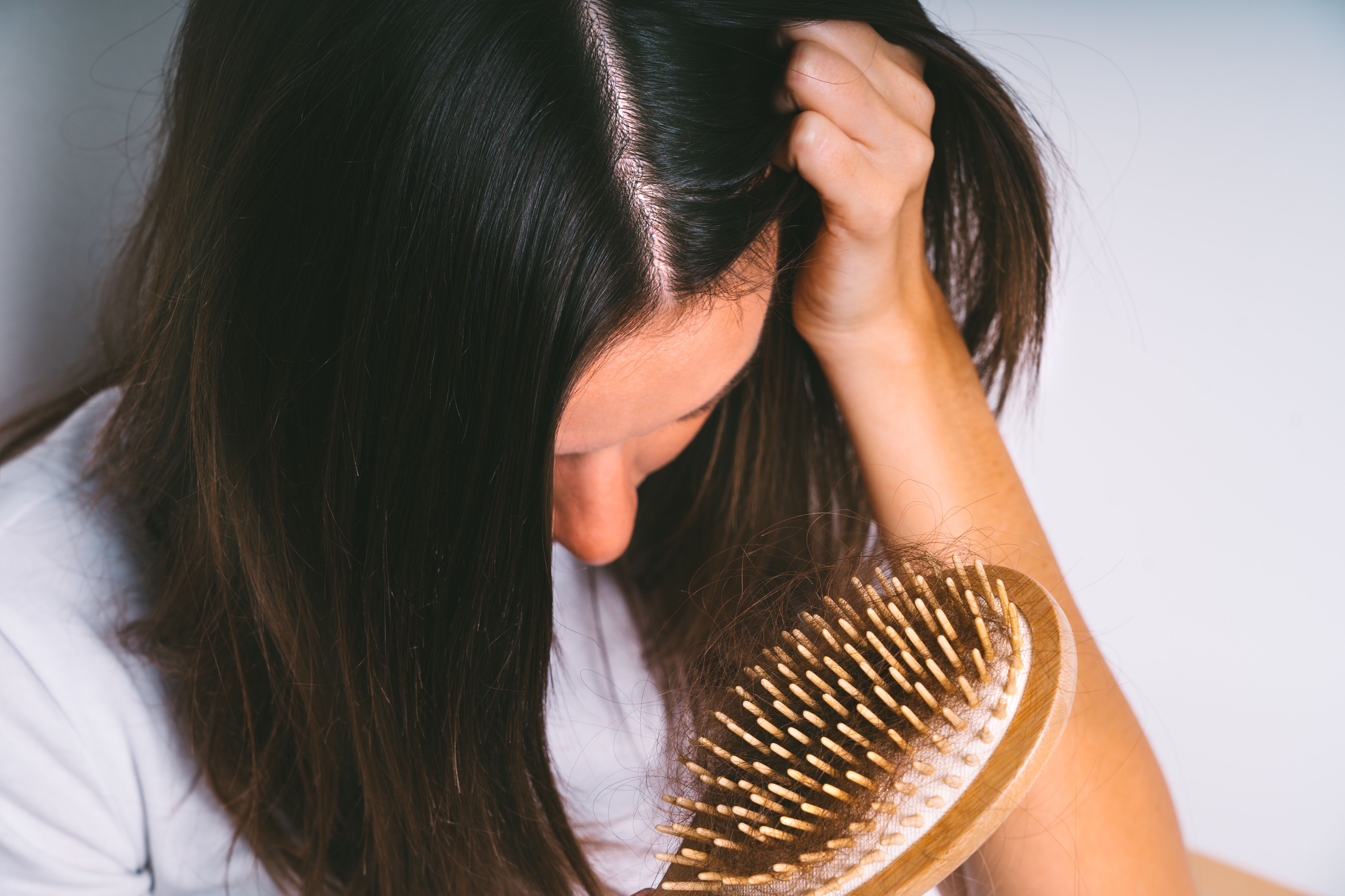 Exploring Identity, Appearance Experiences Among Patients With Alopecia | AJMC