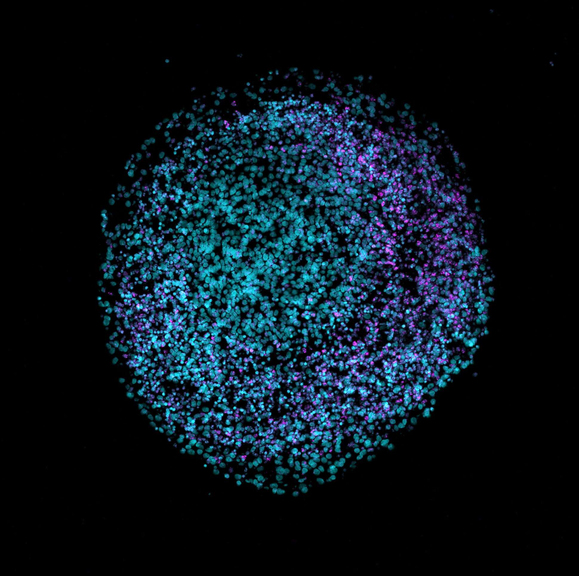 Scientists Are Building Computers Out of Living Brain Cells