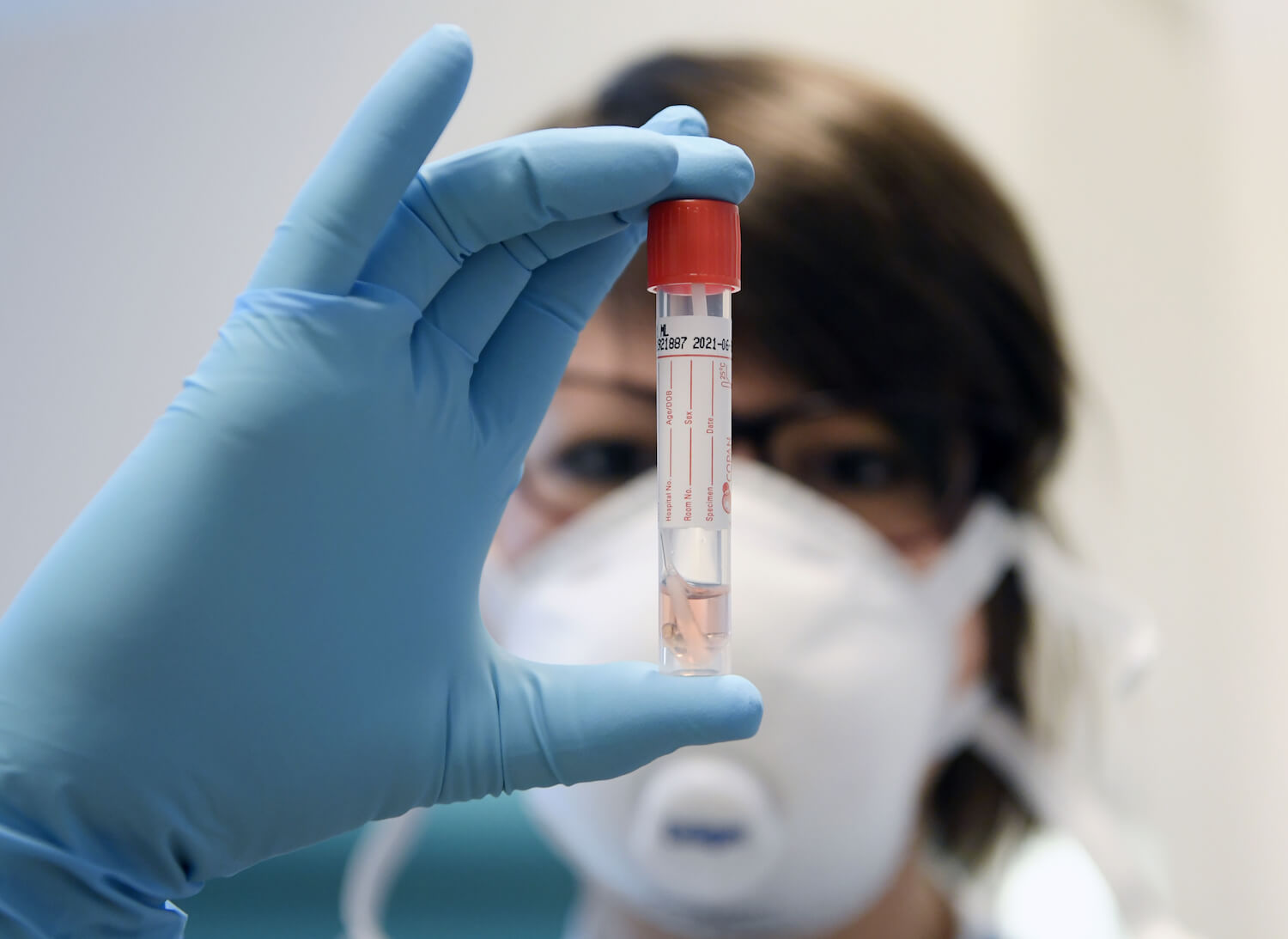 Coronavirus: Warum die Aussagen von Wolfgang Wodarg wenig mit Wissenschaft zu tun haben - correctiv.org