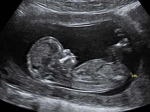 Next Steps for the Pro-Life Movement - The American Way of Life