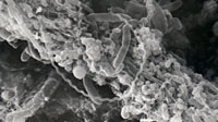 Bacteria at Hydrothermal Vents