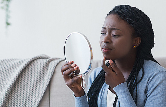 Acne: Considerations for darker skin - Harvard Health