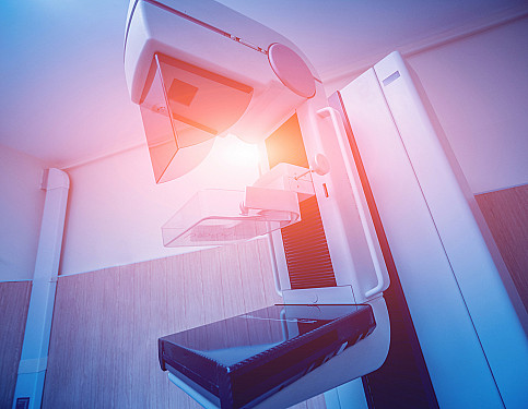 Screening mammograms: One recommendation may not fit all - Harvard Health