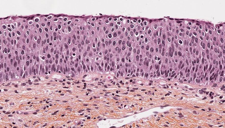 Competition: TissueNet: Detect Lesions in Cervical Biopsies