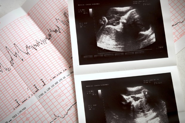 My Abortion Story - Feminist Majority Foundation