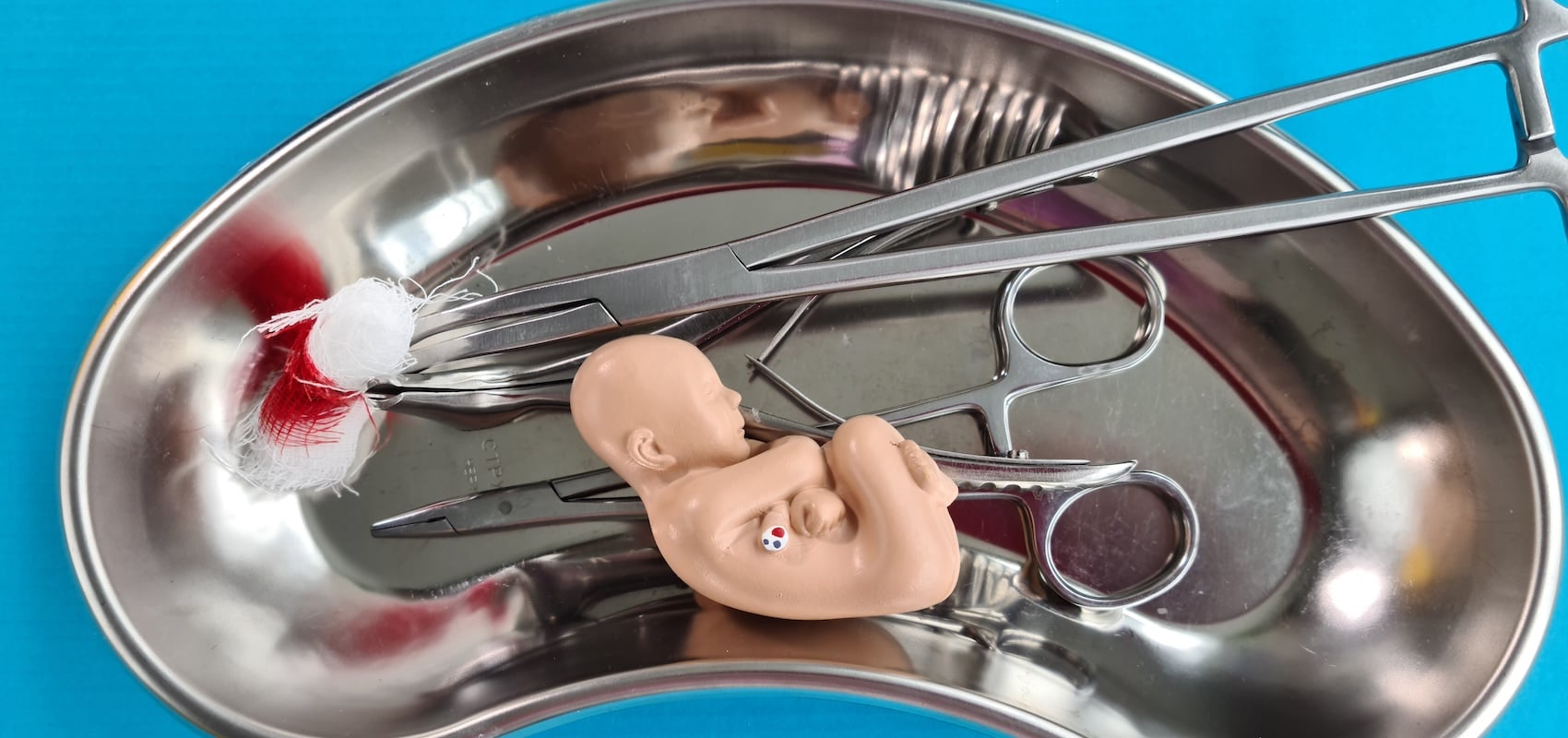 Undercover in Canada’s Lawless Abortion Industry - First Things
