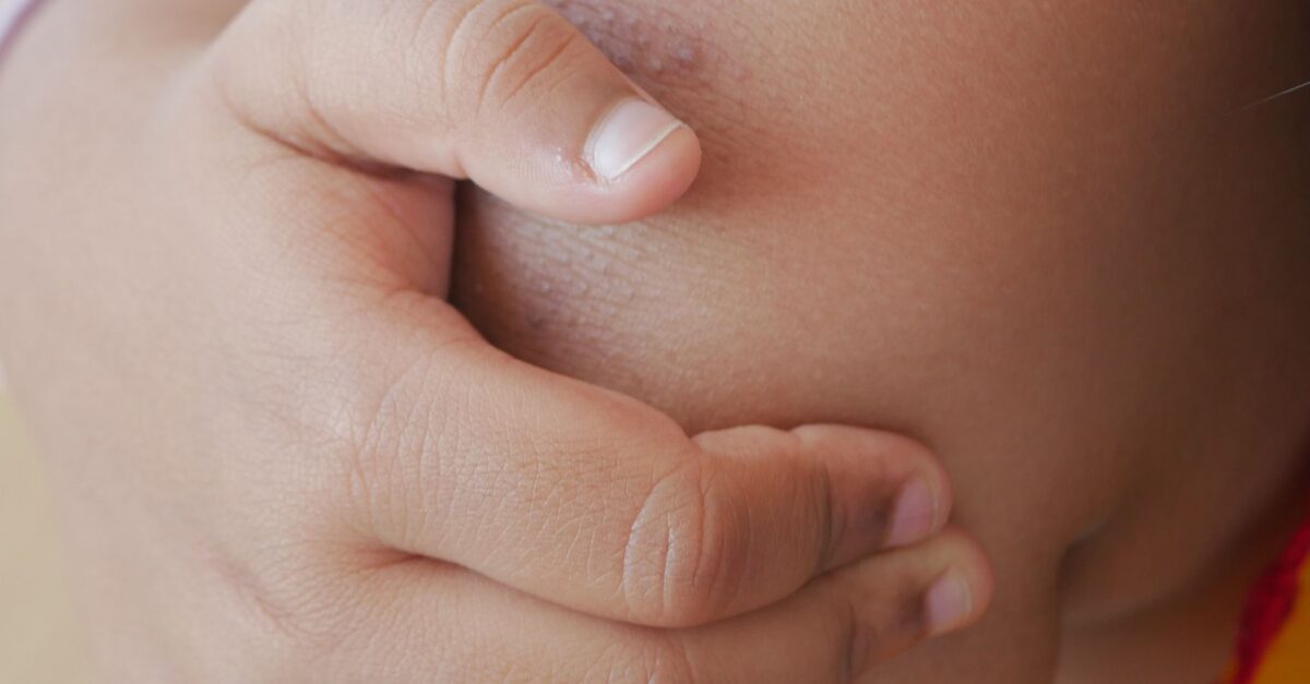 Growing pains: What parents should know - CHOC - Children's Health Hub