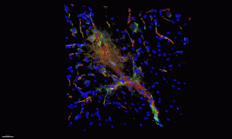 Gut microbiome influences ALS outcomes | HSCRB