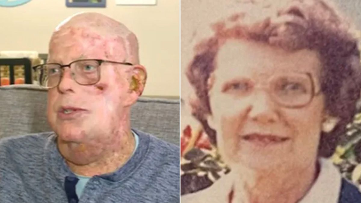 Bloke marks his kidney's 100th birthday as mum's organ still alive and kicking - Daily Star