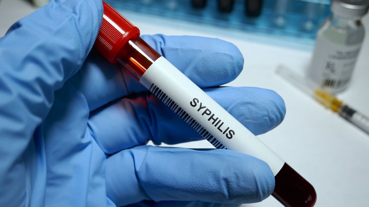 Syphilis epidemic breaks out in the US as STI clinics struggle to get antibiotics - The Mirror