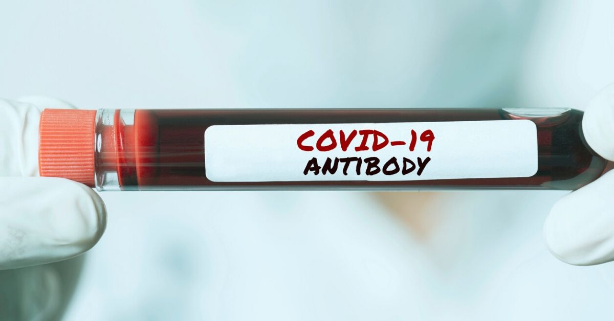 New Protective COVID-19 Antibodies Tested Effective