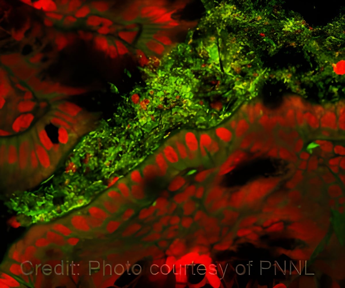 Gut Microbiome Aids to Reduce Chemo's Side Effects