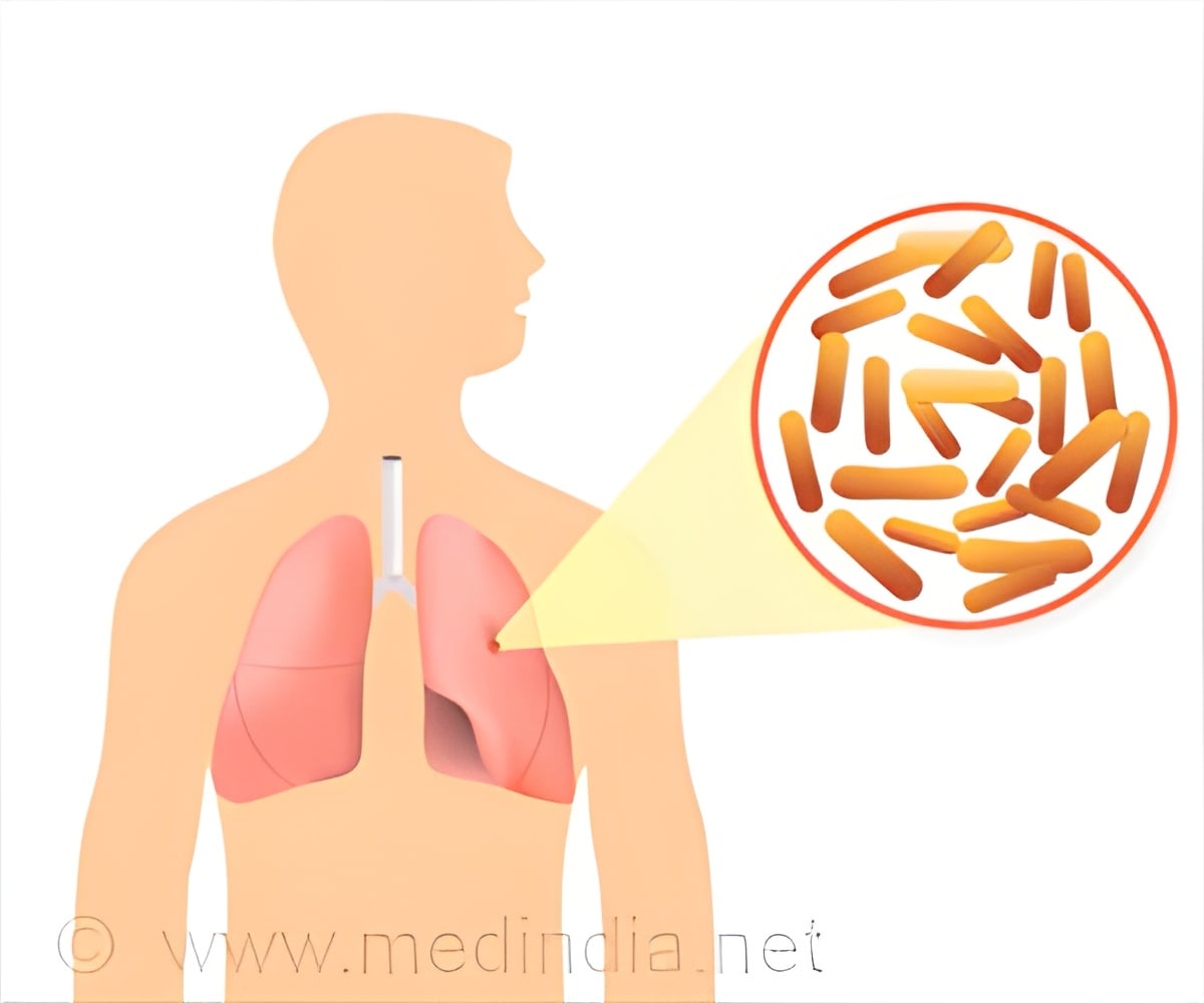 Correct Antibiotic Dosing Could Preserve Lung Microbial Diversity in Cystic Fibrosis, Says Study