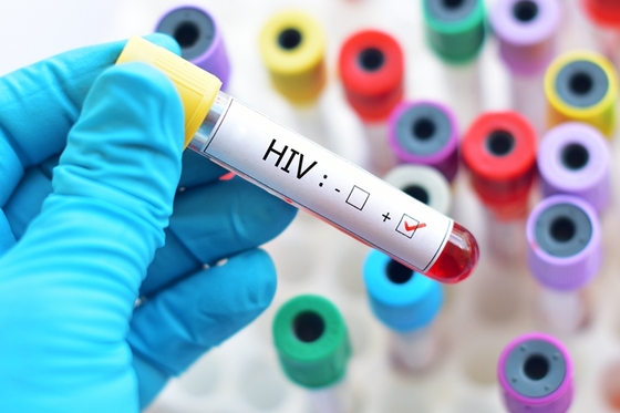 HIV/AIDS Cases in China Fell 13% During Pandemic, Expert Says - Caixin Global