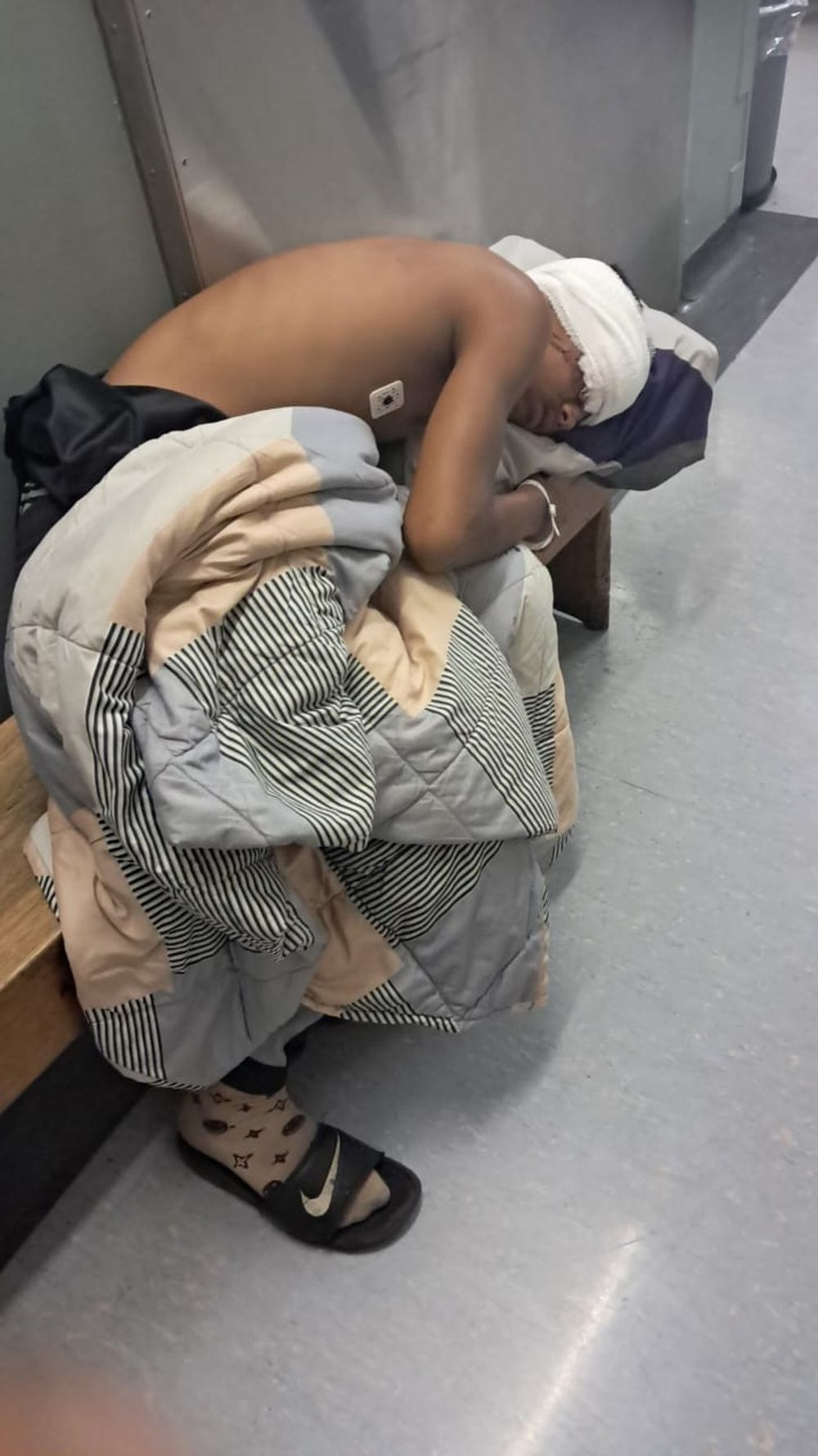 BOY LOSES EYE AT PROTEST