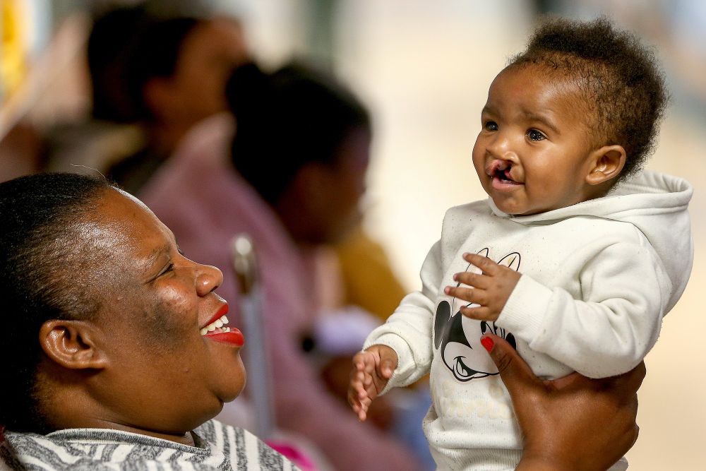 I love your smile: Tygerberg helps kids get surgery
