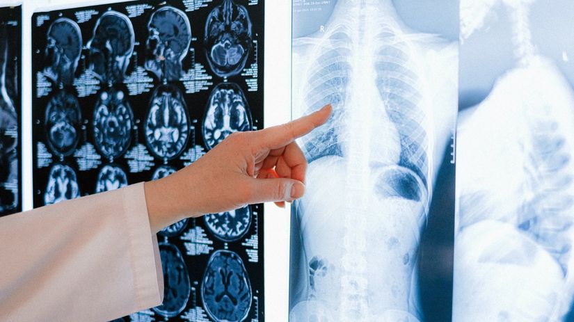 Obrovský objav v medicíne. Vedci slávia úspech proti jednej z najhorších chorôb - Zdravie a prevencia - Zdravie - Pravda