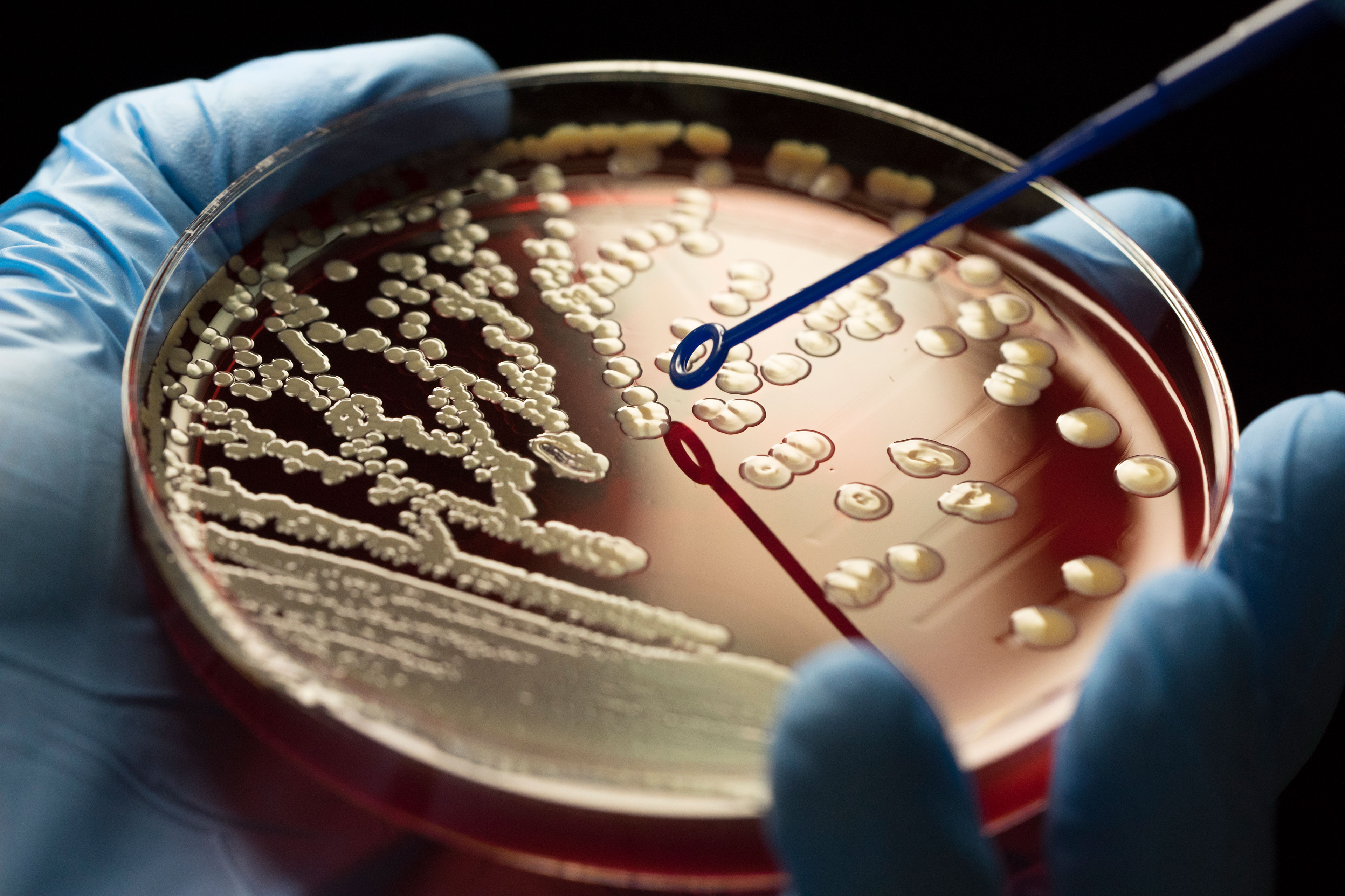 Is Legislation to Safeguard Americans Against Superbugs a Boondoggle or Breakthrough? - KFF Health News
