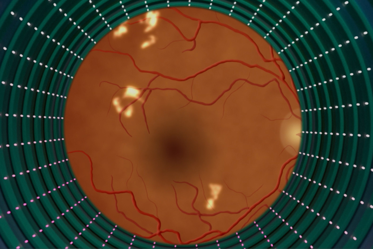Programas de inteligencia artificial diagnostican retinopatía diabética en minutos - KFF Health News