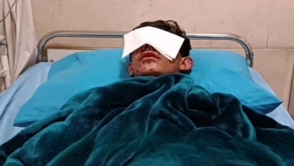آریان ممندی، کولبر ۱۷ ساله یک چشم خود را از دست داد
