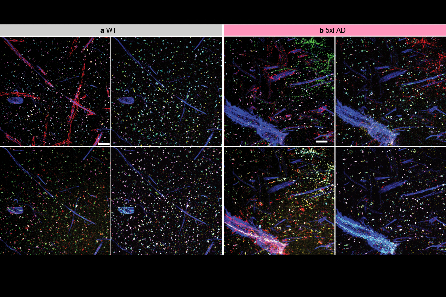 Seeing more in expansion microscopy - MIT McGovern Institute