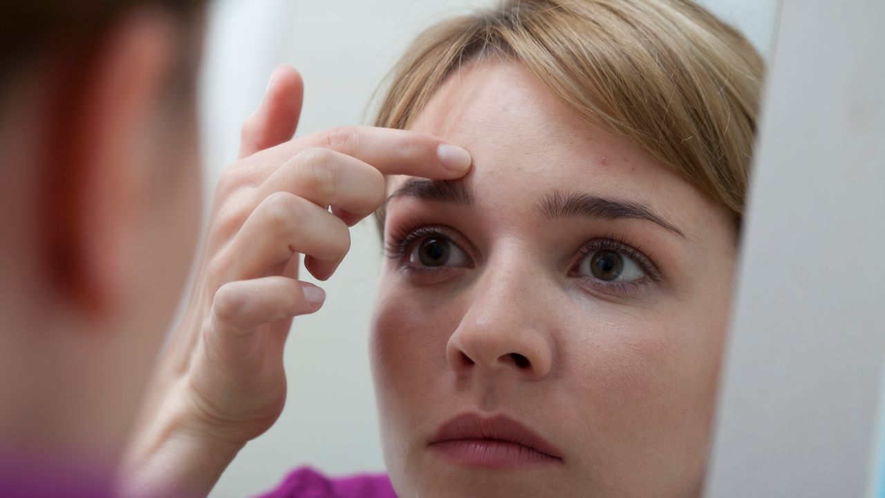 How to Get Rid of Forehead Wrinkles, According to Dermatologists | Glamour