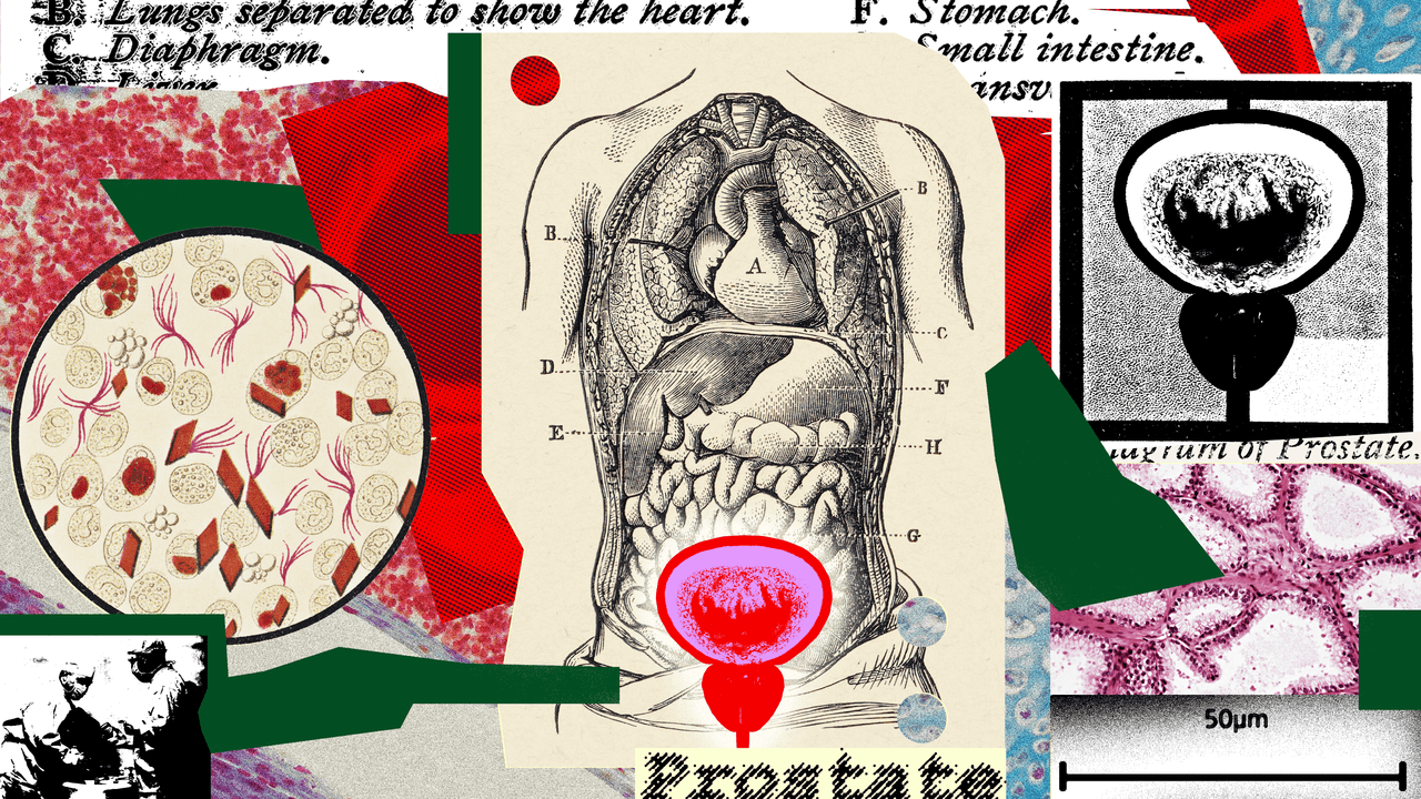 What Every Guy Needs to Know About Prostate Cancer | GQ