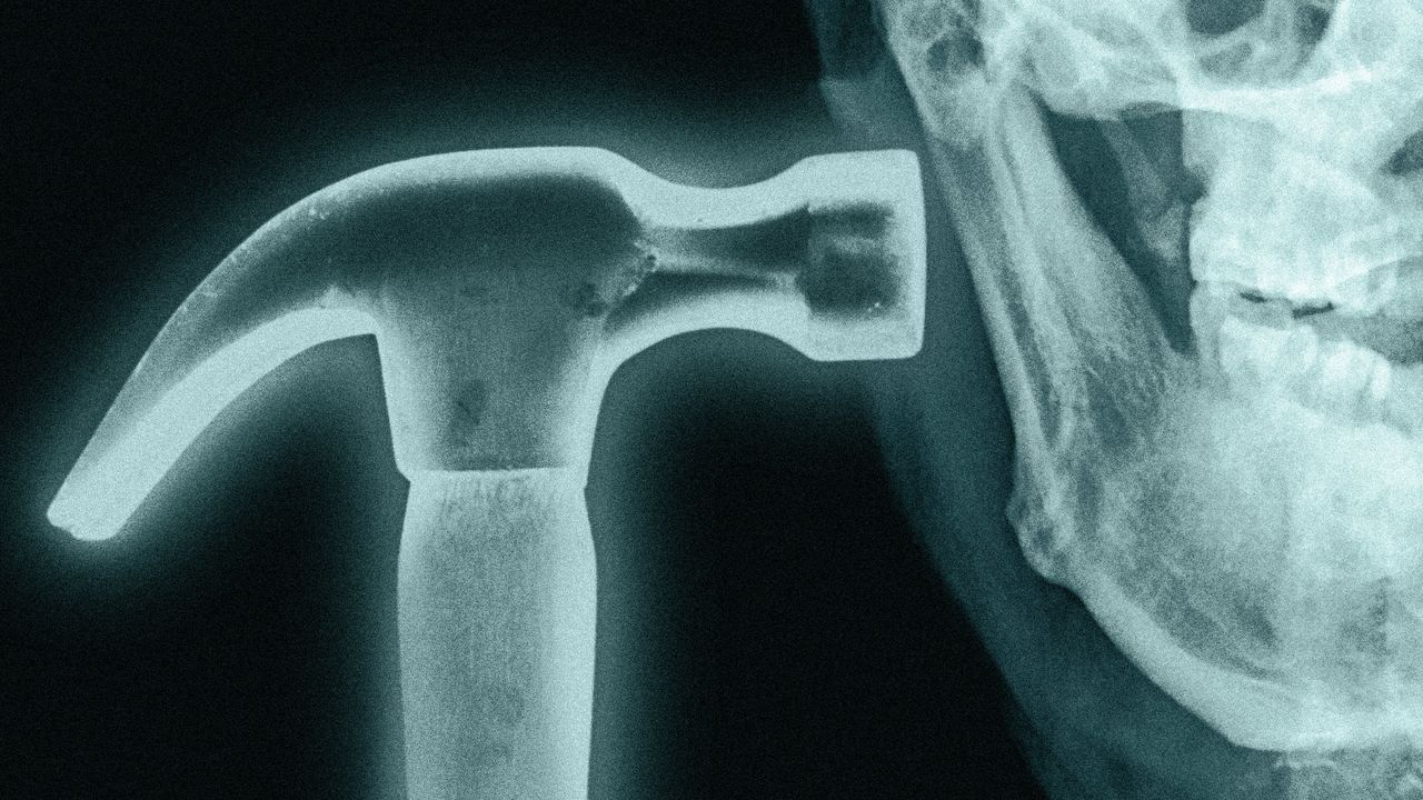What is Bonesmashing? Inside the Extreme Looksmaxxer Technique | GQ